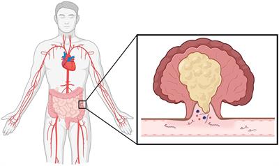 The utility of liquid biopsy-based methylation biomarkers for colorectal cancer detection